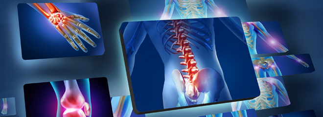 xray showing the need for back pain treatment
